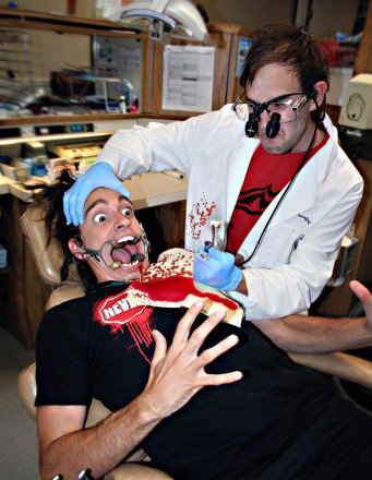 Gingivitis