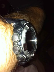buttons on wrist