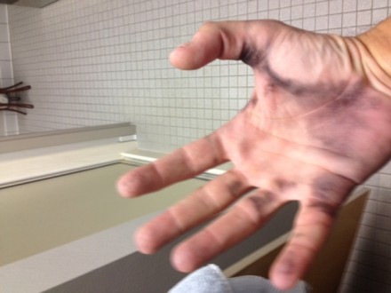 hand stains from gloves